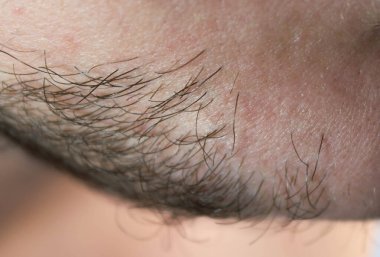 Erkek sakalının Macro fotoğrafı. Kapat.