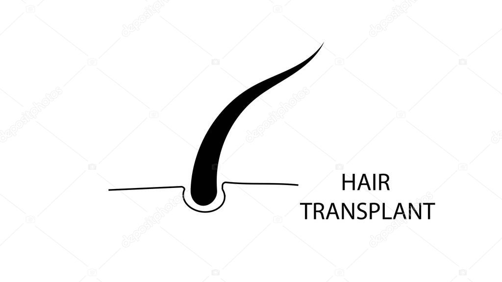 Hair loss stages set of before and after steps