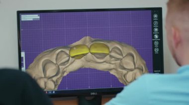 NEW YORK - 5 Nisan 2020: Bilgisayar dişleri üzerinde diş implant ekipmanları medikal stomatoloji teknolojisi teşhisi