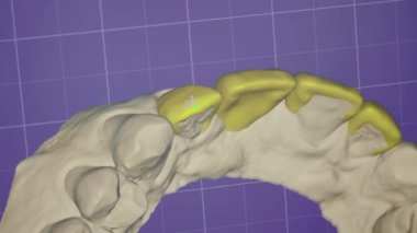 Bilgisayar diş implantı ekipmanlarında 3 boyutlu modelleme dişlerini kapatın Tıbbi stomatoloji teknolojisi tanısı tarama dişleri yavaş çekim
