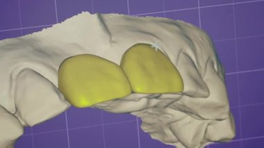 3 boyutlu diş modelleme ekranı, bilgisayar diş implantı ekipmanları tıbbi stomatoloji teknolojisi tanısı, diş taraması, yavaş çekim.