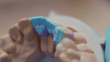 Diş temizliği doktoru teknisyen sağlık kliniği hijyen cerrahi rehabilitasyonu ağır çekimde çalışır.