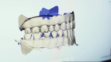 NEW YORK - 19 Şubat 2020: Yeni sahte diş çene şablonu modelinin animasyon çekimi ekranda dönüyor. Klinikteki müşteriler için yeni yapay diş implantları modelleyen diş teknisyeni.