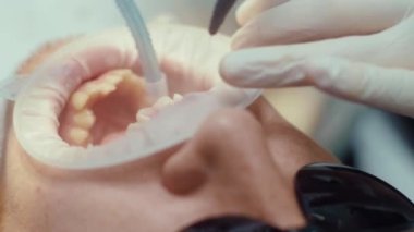 Yüz ve el dişçisi diş teli takar. Ortodontiste resepsiyon. Cilalıyorum. Ağız cerrahisi kliniği dişleri. Yavaş çekim