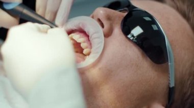 Koruyucu gözlüklü, ağır çekim suratlı adam. Eller kapalı, dişçi diş teli takıyor. Ortodontiste resepsiyon. Cilalıyorum. Ağız cerrahisi kliniği destek dişleri.