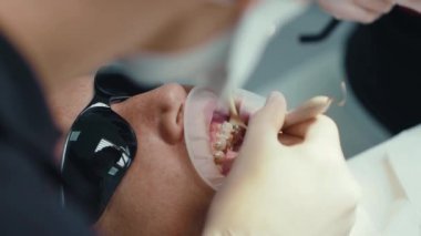 Eller dişçi koruyucu gözlüklü adama diş teli takar. Ortodontiste resepsiyon. Cilalıyorum. Ağız cerrahisi kliniği dişleri. Yavaş çekim