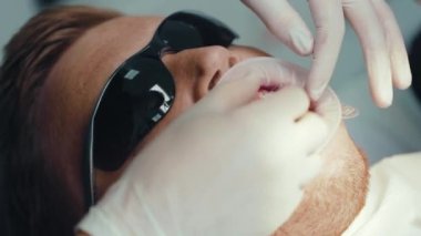 Eller kapalı dişçi özel aletlerle diş tellerini erkek dişine takıyor. Ortodontiste resepsiyon. Cilalıyorum. Bakım kliniği parantezi dişleri. Yavaş çekim