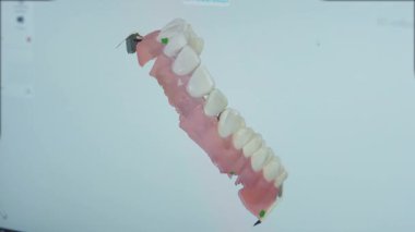 NEW YORK - 19 Şubat 2020: Bilgisayar ekranında yapay diş üretiminin dönen modeli. Diş teknisyeni fen laboratuarında yeni çıkarılabilir çene yapıyor. Diş sağlığı konsepti.