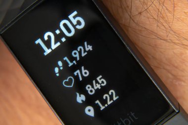 Calgary, Alberta, Kanada. Sep 23, 2020. Bileğine 3 şarj aleti takan biri.