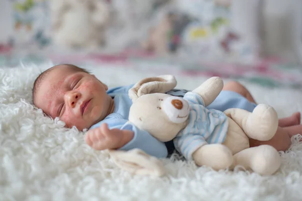 Pequeño Bebé Recién Nacido Mirando Bebé Con Erupción Cutánea Dermatitis — Foto de Stock