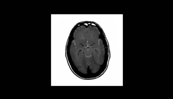 Brain CT Scan (Head Computed Tomography) of Healthy Male /High Resolution Image