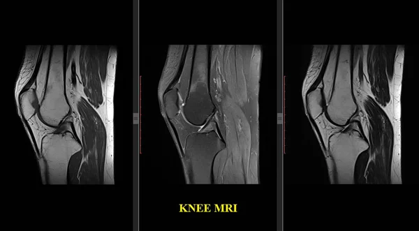 Knee Joint MRI of a Healthy Adult (Magnetic Resonance) High  Resolution