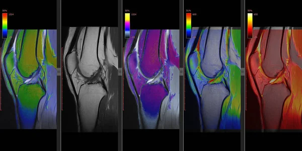 Knee Joint MRI of a Healthy Adult (Magnetic Resonance) High  Resolution