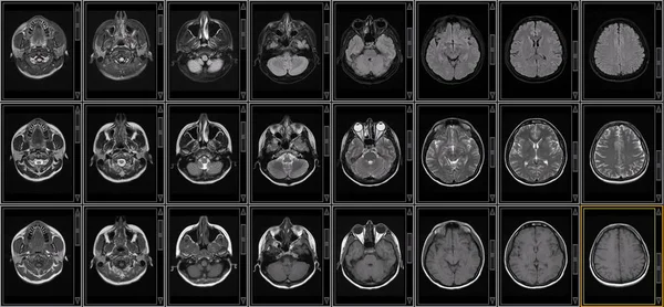 Brain MRI Scan of Healthy Male  (Magnetic Resonance Imaging) High Resolution