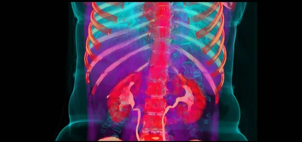 3D Body CT - Medical Imaging- Radiology- High Resolution Abdomen  Computed Tomography