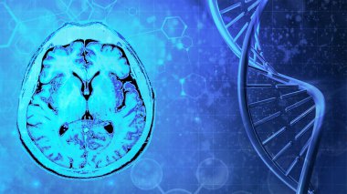dna str ile beyin bindirme manyetik rezonans görüntü (Mri)