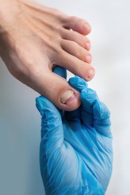 Bacağı yaralı çiviye. Doktor hasta inceliyor