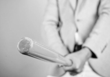 Cinsel kudret. Sembol erkek genital ereksiyon taklit büyük tahta beysbol sopası tutuşun. İyi ereksiyon sırları. Testosteron booster. Sağlık ve erkek cinsellik kavramı. Erkek Sağlık ve montajı