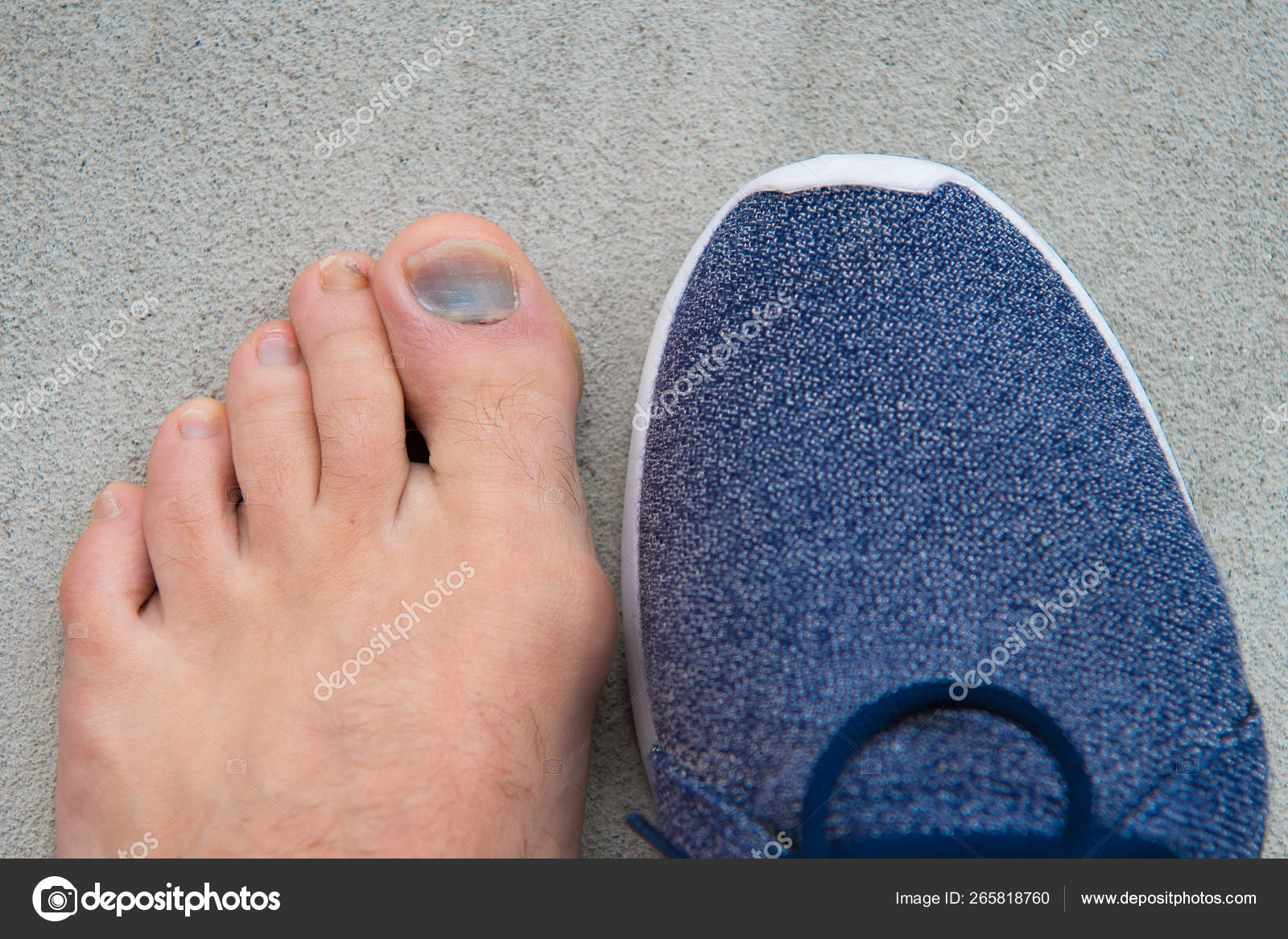 gomba nail foot medicine