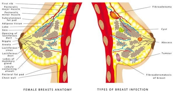 乳房の解剖学 女性の胸クリニック 学校のための基本的な医療教育のための解剖学的断面図 女性のバストを設定します 白い背景の上乳の異なる種類 — ストックベクタ