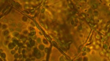 Cryptocoryne hücreleri. Araceae familyasından gelen su bitkilerinin cryptocoryne-cinsi. Sitoplazmik Akış - kloroplasthareketi, Cryptocoryne hücrelerinde klorofil - mikroskopi, büyütme 100x