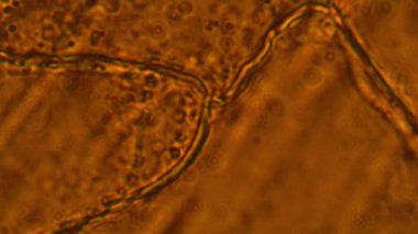 Mikroskop altında sarımsak hücreleri. Mitoz - Epitel hücreleri Sarımsak cilt görünümü mikroskop altında. Sarımsak deri skalası epidermis hücrelerinde sitoplazmik akış (organellerin hareketi)