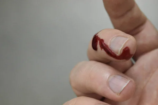 Bleeding Finger Hand White Background — Stock Photo, Image