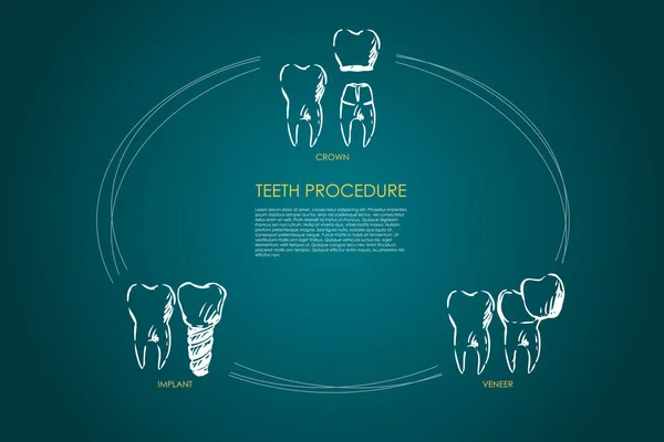 Procedimiento dental corona, chapa, implante vector concepto conjunto — Vector de stock