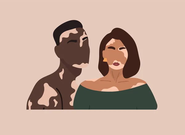 Silhouette de couple abstraite avec vitiligo de différentes nationalités debout ensemble. Concept vectoriel pour soutenir les personnes vivant avec le vitiligo et sensibiliser sur les troubles chroniques de la peau. — Image vectorielle