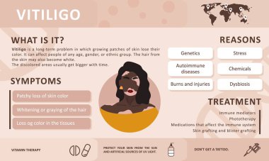 Vitiligo 'nun bilgileri. Hastalığın nedenleri. Soyut Afrikalı kadın silueti. Vitiligo ile yaşayan insanları desteklemek ve kronik deri hastalığı hakkında farkındalık yaratmak için vektör kavramı. Kişisel bakım.