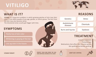 Vitiligo 'nun bilgileri. Hastalığın nedenleri. Soyut Afrikalı erkek silueti. Vitiligo ile yaşayan insanları desteklemek ve kronik deri hastalığı hakkında farkındalık yaratmak için vektör kavramı. Kişisel bakım.