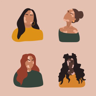 Farklı milletlerden vitiligolu soyut kadın siluetleri. Vitiligo ile yaşayan insanları desteklemek ve kronik deri hastalığı hakkında farkındalık yaratmak için vektör kavramı. Kendine dikkat et ve kendini sev..