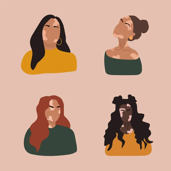 Femeile abstracte siluete cu vitiligo de diferite naționalități. Conceptul vectorial pentru a sprijini persoanele care trăiesc cu vitiligo și pentru a construi conștientizarea cu privire la tulburarea cronică a pielii. Îngrijirea de sine și iubirea de sine . — Vector de stoc