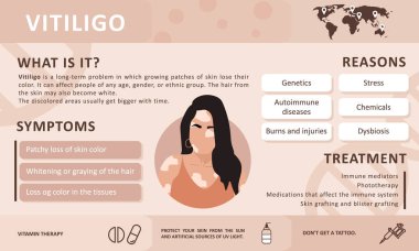 Vitiligo 'nun bilgileri. Hastalığın nedenleri. Soyut kadın silueti. Vitiligo ile yaşayan insanları desteklemek ve kronik deri hastalığı hakkında farkındalık yaratmak için vektör kavramı. Kişisel bakım.