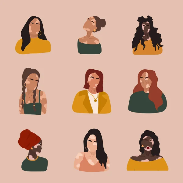 Abstract women silhouettes with vitiligo of different nationalities. Vector concept to support people living with vitiligo and to build awareness about chronic skin disorder. Self care and self love. — Stock Vector