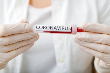 Coronavirus kan testi sonucu vakum test tüpündeki koronavirüs enfeksiyonu laboratuvarda Coronavirus metniyle doktorların ellerinde. Tanı, tespit, Çin koronavirüsü analizi. Salgın..