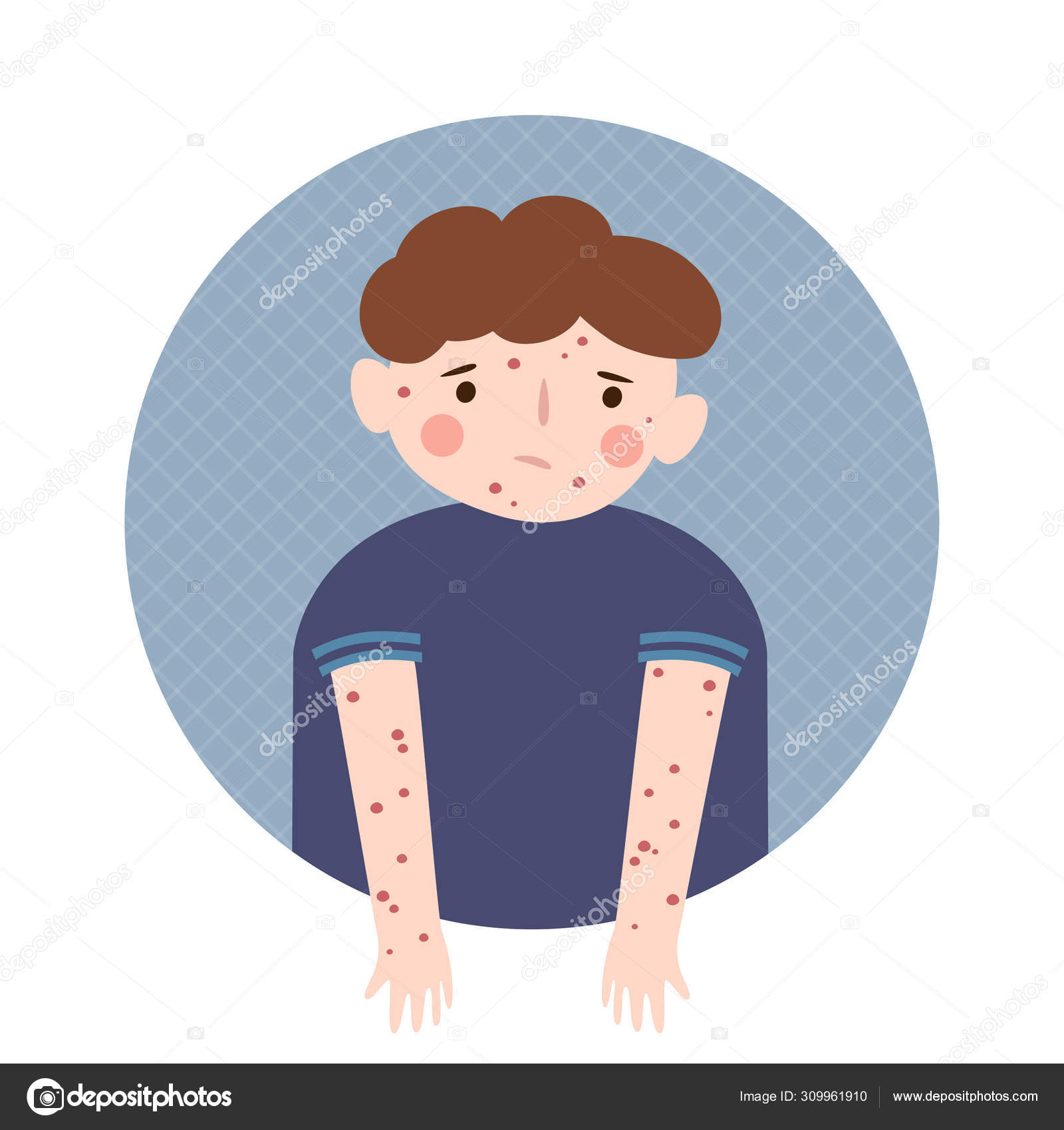 Chicken pox Vector Art Stock Images | Depositphotos Chicken pox Vector Art Stock Images | Depositphotos