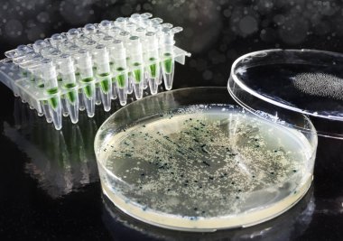 petri kabına agar-agar üzerinde bakteri kolonileri ile