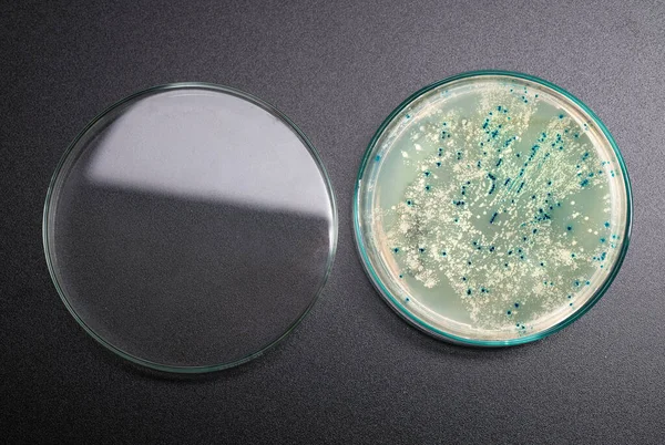 Plazmid vektör klonlaması için bakteri kolonileri olan Agar plaka — Stok fotoğraf