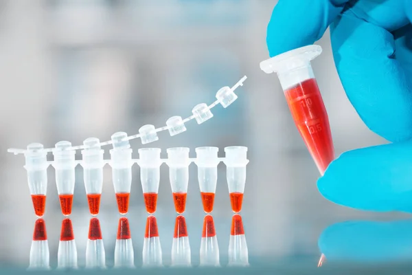 DNA amplification test and reaction mixture in gloved hand — 스톡 사진