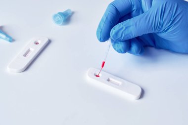 İgm ve IgG 'nin Corona virüsü SARS-CoV-2' yi geliştirerek Covid19 hastalığına neden olan özel antikorların tespiti için hızlı COVID-19 testi. Sıhhiye ya da doktor hasta parmağından alınan kanı teste uygular..