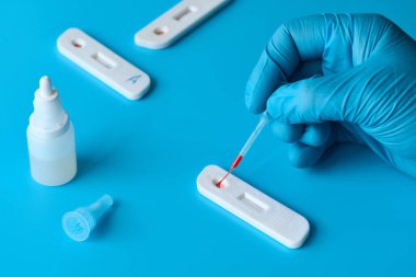 İgm ve IgG antikorları için COVID-19 testi yapın. Yeni Coronavirus SARS-CoV-2, Covid-19. Eldivendeki doktor kan testine tek kullanımlık pipetle kan uygular. Mavi naneli turkuaz arkaplan.