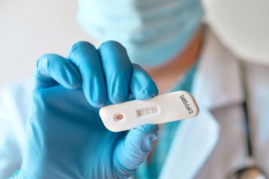 Doktor, Novel Coronavirus, SARS-CoV-2 ve pozitif bantlı IgM ve IgG antikorlarının tespiti için hızlı laboratuvar COVID-19 test şeridi gösteriyor. Covid-19 'a karşı bağışıklık, solunum viral pnömonisi.