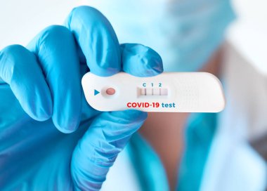 Doktor, Novel Coronavirus, SARS-CoV-2 'ye IgM ve IgG antikorlarının tespiti için hızlı laboratuvar COVID-19 testi gösteriyor. Yeni patojene karşı dokunulmazlık dünya çapında salgınlara neden oluyor.