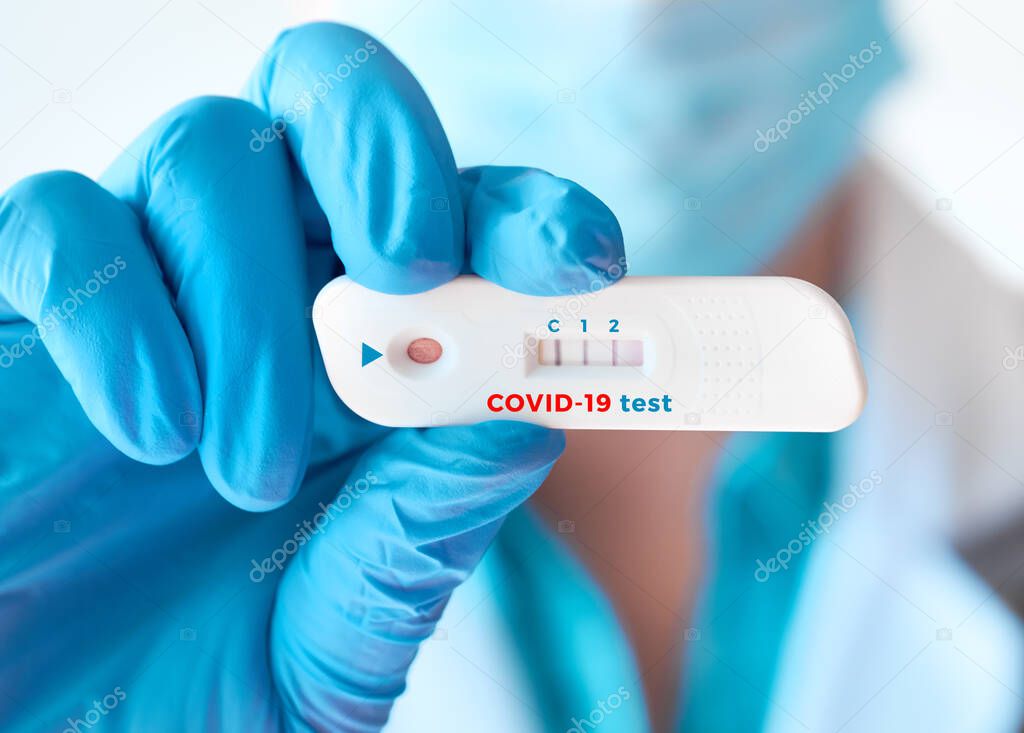 Doctor shows rapid laboratory COVID-19 test for detection of IgM and IgG antibodies to Novel Coronavirus, SARS-CoV-2 with positive result. Immunity against novel pathogen causing worldwide pandemics.