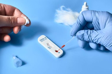 İgm ve IgG antikorları için COVID-19 testi yapın. Yeni Coronavirus SARS-CoV-2, Covid-19. Mavi eldivenli hemşire kan testi uygular. Pamuklu parmaklar. Canlı neon mor arkaplan.
