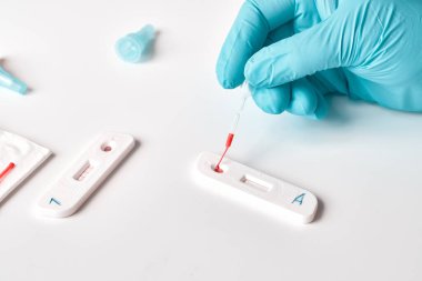 Covid-19 'a neden olan Corona virüsü SARS-CoV-2' yi geliştirmek için IgM ve IgG antikorlarının tespiti için hızlı COVID-19 testi. Sıhhiye ya da hemşire hasta parmağından alınan kanı tek kullanımlık pipetle doldurur..