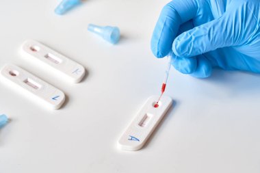 Covid-19 'a neden olan Coronavirus SARS-CoV-2' yi geliştirmek için IgM ve IgG antikorlarının tespiti için COVID-19 testi yapın. Sıhhiye ya da doktor hasta parmağından alınan kanı pipetle uygular.