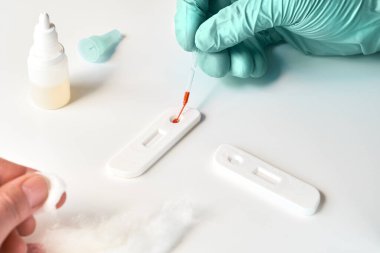 Covid-19 'a neden olan Corona virüsü SARS-CoV-2' yi geliştirmek için IgM ve IgG antikorlarının tespiti için hızlı COVID-19 testi. Sıhhiye, testte pipeti olan hasta parmağından kan aldı..