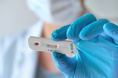 Hemşire ya da doktor Novel Coronavirus, SARS-CoV-2 'ye hem IgM hem de IgG antikorları için hızlı COVID-19 testi gösteriyor. Sürü dokunulmazlığı halkı bu yeni virüsten koruyor..